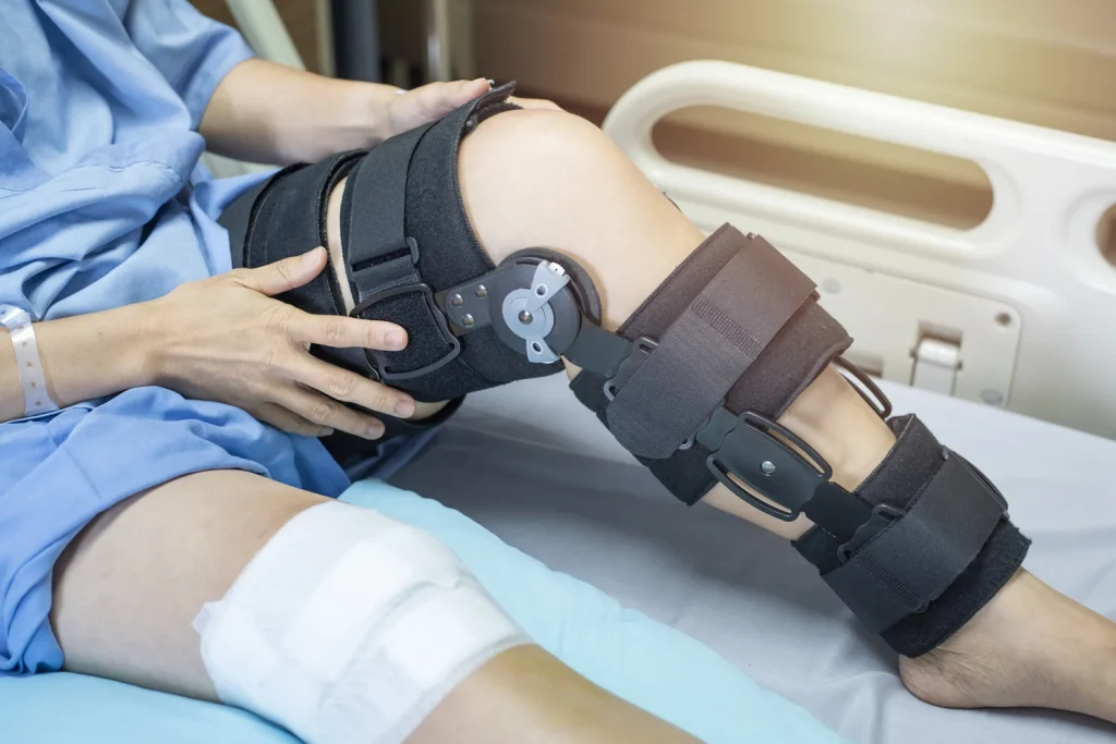 Can a Knee Brace Prevent Acl Injury