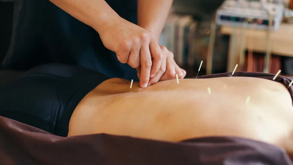 Does Acupuncture Work Weight Loss
