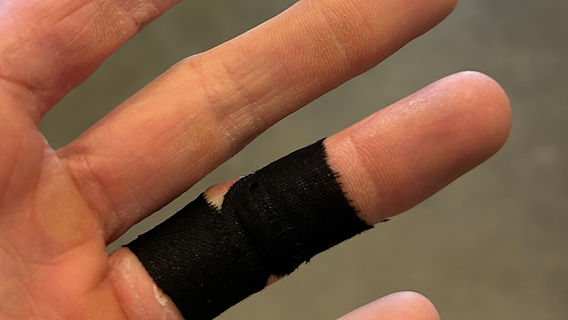How to Prevent Finger Injuries Climbing